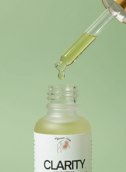 Acne Serum Deal – Clear Skin Solution for Pimples & Marks