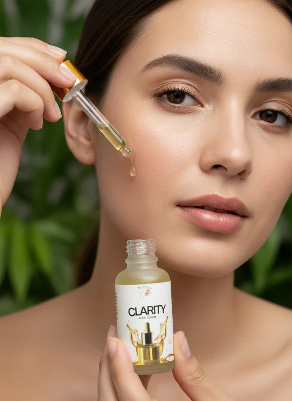 Clarity Serum for Acne, Pimples & Oil Control | Acne Marks & Dark Spots Reducer | Original | 30ml